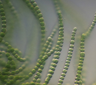 Сине-зеленые водоросли под микроскопом